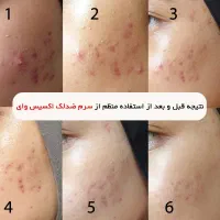 سرخ ضد لک و جوش اکسیس وای اورجینال با ضمانت|آرایشی، بهداشتی، درمانی|فردیس, قریشی|دیوار