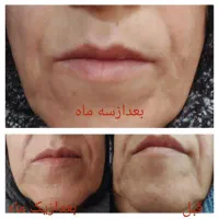سرم جوانساز گل رز آریا|آرایشی، بهداشتی، درمانی|شیراز, عفیف‌آباد|دیوار