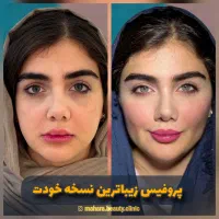 تخفیف یانگ فیس صورت ابرو پزشک پوست مو بینی زیبایی