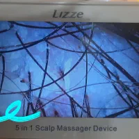 پاکسازی تخصصی سر از شوره و خارش تخفیف ویژه