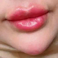 آف پنجاه درصد ژل و بوتاکس با بهترین برند|خدمات آرایشگری و زیبایی|اهواز, شریعتی جنوبی|دیوار