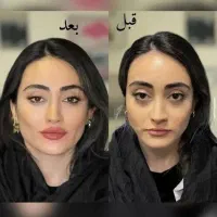 آف ویژه فیلر فول فسی  و مدلینگ صورت فقط ۳۹۰۰|خدمات آرایشگری و زیبایی|کرج, گوهردشت|دیوار