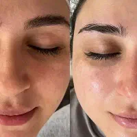 فشیال صورت