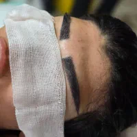 کاشت مو ابرو ریش مزوتراپی و پی آرپی جشنواره پاییزه|خدمات آرایشگری و زیبایی|اردبیل, |دیوار