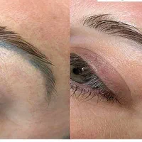 پاک کردن و ریموو تاتو صورت بدون عوارض و در یک جلسه|خدمات آرایشگری و زیبایی|تهران, دهکده المپیک|دیوار