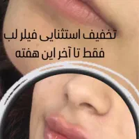 بوتاکس، فیلر و خدمات پیرسینگ|خدمات آرایشگری و زیبایی|رشت, خواهر امام|دیوار