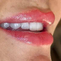 دندانپزشکی/لمینیت/ایمپلنت ( نصف قیمت تعرفه )|خدمات آرایشگری و زیبایی|تهران, فلسطین (میدان انقلاب)|دیوار