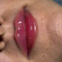 لیزر/هایفو/فیشیال/ژل و بوتاکس/جراحی های سرپایی