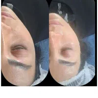 اف ۵۰درصدی فیشیال وپاکسازی حرفه ای با ار اف رایگان