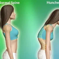 اصلاح ستون فقرات
