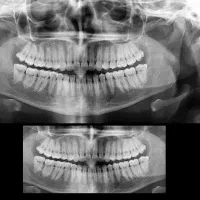 دستیار دندان پزشک با سابقه