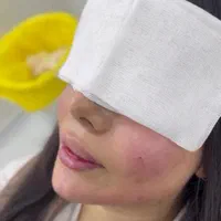 تزریق ژل و بوتاکس جشنواره عید|خدمات آرایشگری و زیبایی|تهران, عبدل‌آباد|دیوار