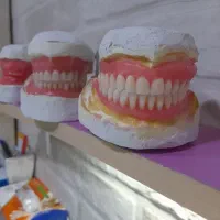 ساخت دندان‌های خارجی ژله‌ای تخفیف ویژه