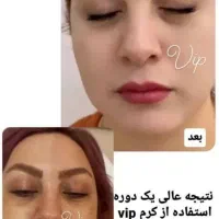 فرمول کرم سفید کننده قوی صورت ودستوپا تضمینی|آرایشی، بهداشتی، درمانی|ایرانشهر, |دیوار