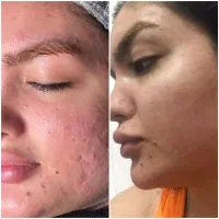 کلینیک زیبایی لیزر مو مهرگان انقلاب