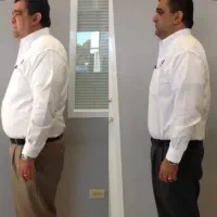 لاغری با بدون عوارض