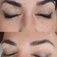 مدل برای پاک کردن تتو قدیمی