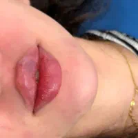 فیلر هر برندی مشتری بخواد