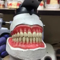 دندانسازی(دندان مصنوعی)(تعویض روکش های دندانی)