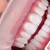 دستیار جراح فک و صورت و ایمپلنت