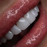 دندانپزشکی بیمه تکمیلی آسیا دانا ملت پاسارگاد معلم