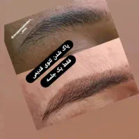 مرکز تخصصی ریموو تتو.شیدینگ لب.میکرو.آموزش|خدمات آرایشگری و زیبایی|گرگان, |دیوار