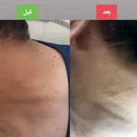 درمان|آرایشی، بهداشتی، درمانی|فیروزآباد (لرستان), |دیوار