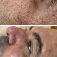 لیزر موهای زائد میکروسویچ و اپلومد کندلا وایتنینگ|خدمات آرایشگری و زیبایی|اصفهان, طامه|دیوار