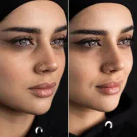 مدل فیلرلب رایگان۵۹۹ مدل بوتاکس فیلرزیرچشم پیرسینگ