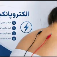 درمان با طب سوزنی