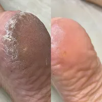 خدمات اسپا و پدیکور|خدمات آرایشگری و زیبایی|شیراز, شهرک ایثار|دیوار