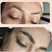 ریموو تتو ابرو.بوتاکس رویش موی سر و ابرو