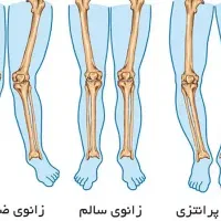 دعوت به کارحرکات اصلاحی یاکایروپراکتیک پس از آموزش