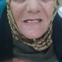 دندانسازی|خدمات آرایشگری و زیبایی|قم, علی آباد سعدگان|دیوار