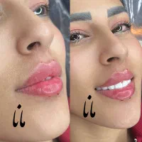 جشنواره ژل لب روسی فیلرزاویه بوتاکس مزو لیزرفیشیال|خدمات آرایشگری و زیبایی|شهریار, شهریار|دیوار