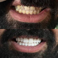 کامپوزیت|خدمات آرایشگری و زیبایی|محمدشهر, محمدشهر|دیوار