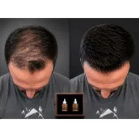 مردانگی واقعی ازچانه هات شروع میشه