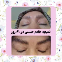 مژه ها و ابروهات رو تقویت کن|خدمات آرایشگری و زیبایی|کرمانشاه, |دیوار