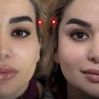 جشنواره ویژه خانم ها و آقایان (کلینیک زیبایی)