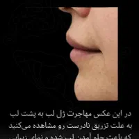مطب زیبایی و لیزر با ده سال سابقه (فلکه جهاد)|خدمات آرایشگری و زیبایی|نورآباد ممسنی, |دیوار