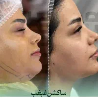 جراحی بلفاروپلاستی وجراحی های زیبایی و تزریقات