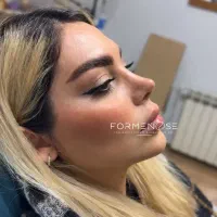 ۲۰میلیون تخفیف جراحی بینی (ظرفیت۲نفر)|خدمات زیبایی و سلامت|اصفهان, شاهزاده ابراهیم|دیوار