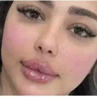 تزریق ژل فیلرلب.بوتاکس مزوژل فیلربادی باتخیفات 50٪|خدمات آرایشگری و زیبایی|زاهدان, |دیوار