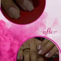 ترمیم و کاشت ناخن تخفیف ویژه