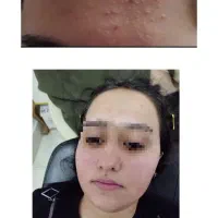 فشیال وپاکسازی پوست فقط۲۵۰