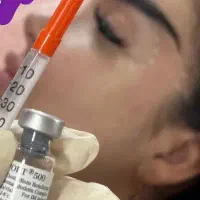 آموزش ژل وبوتاکس