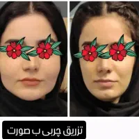 لیفت