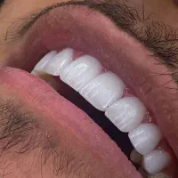 جشنواره ویژه خدمات دندانپزشکی