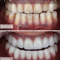 استخدام دندانپزشک برای همکاری در مطب مجهز