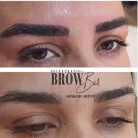 فیبروز و میکروبلدینگ‌ابرو